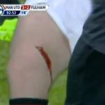 Impresionante corte en la pierna del futbolista Wayne Rooney durante un partido