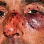 #14N: Escalofriante vídeo de la agresión policial a Carlos Gorairis, activista de PAH