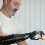 Nigel Ackland perdió su brazo en un accidente y ahora tiene un brazo biónico como el de Terminator