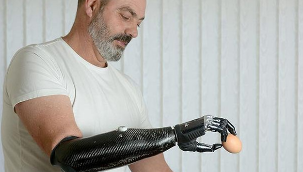 Nigel Ackland perdió su brazo en un accidente y ahora tiene un brazo biónico como el de Terminator
