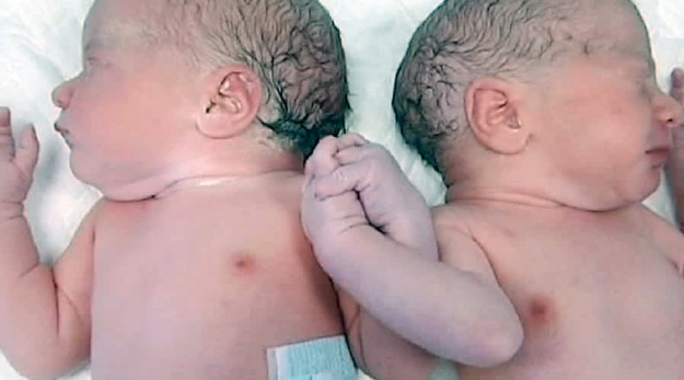 Daniel y María, los mellizos que se dieron la mano nada más nacer