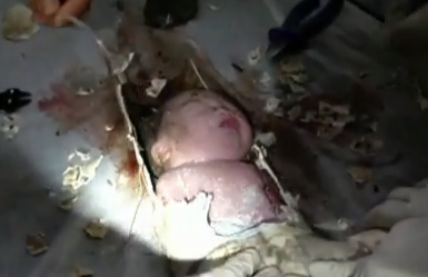 Rescatan a un recién nacido de una tubería de 10 centímetros de diámetro en China