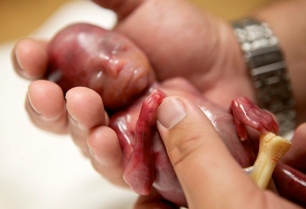 Una mujer muestra las fotos de su hijo nacido a las 19 semanas de embarazo