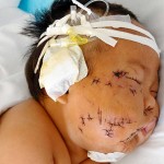 Una madre le clava unas tijeras 90 veces a su hijo de 8 meses porque este la mordió cuando le amamantaba