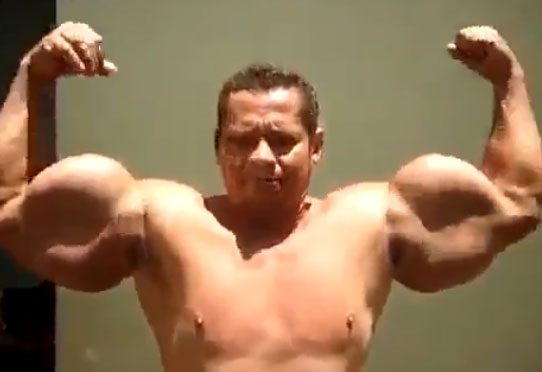 Synthol, o como tener unos brazos como los de Popeye