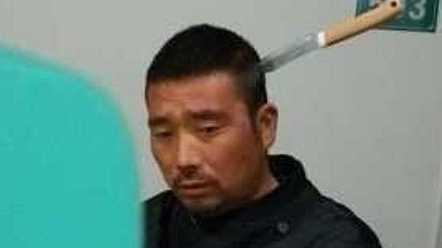 Un chino espera paciente su turno en un hospital con un cuchillo en la cabeza