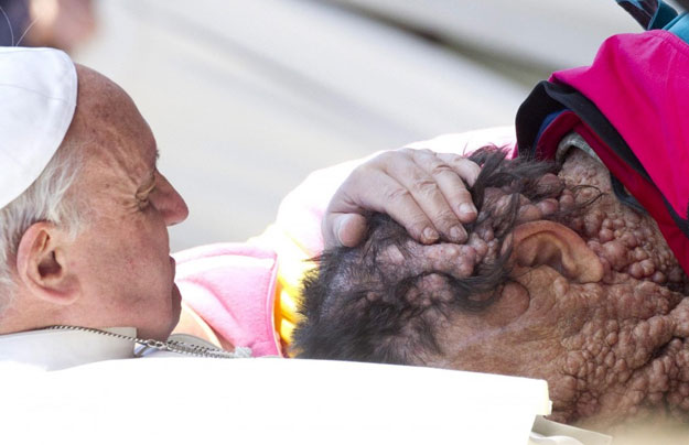 Conmovedor abrazo del Papa Francisco a un hombre enfermo de neurofibromatosis