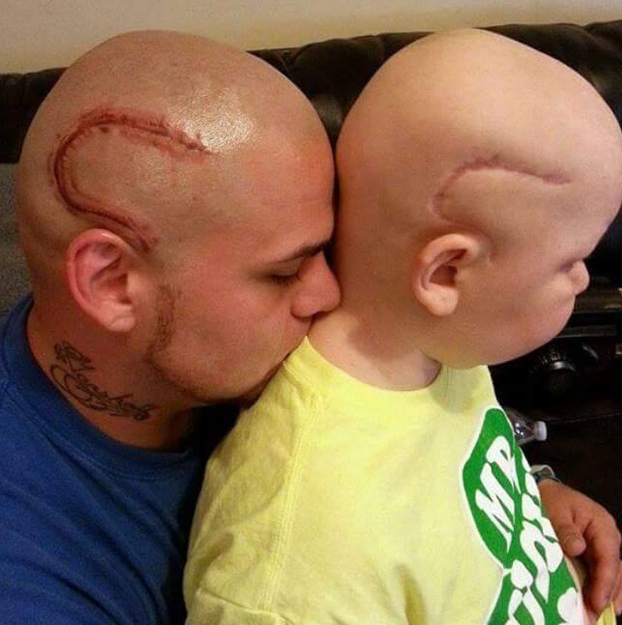 padre-tatua-cabeza-cicatriz-hijo-cancer-2