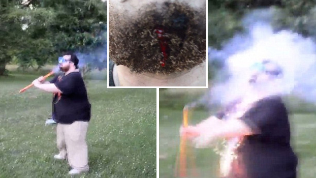 ''No pensé que dolería'': Enciende un fuego artificial y se lo apunta directamente a la cara