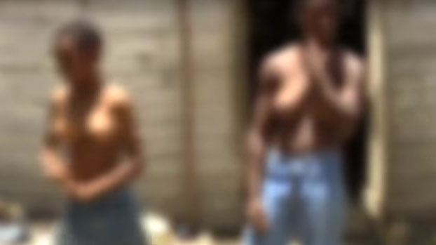 Tres hermanos de República Dominicana desarrollan pechos de mujer