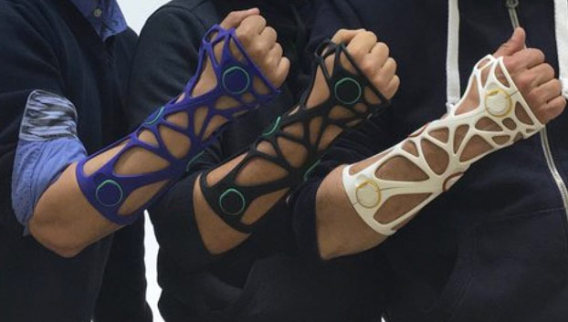 Xkelet, el invento español que sustituirá las escayolas de yeso por férulas diseñadas en 3D