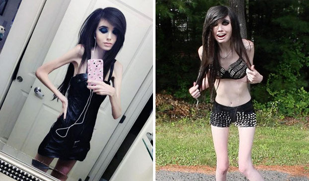 Piden que Youtube cierre el canal de una joven por inducir a la anorexia