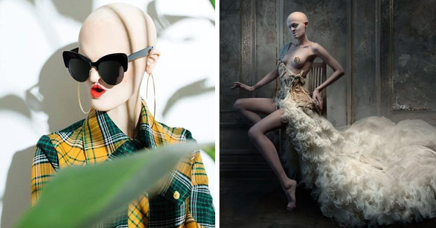 Se llama Melanie Gaydos y es una modelo de 28 años con un raro trastorno genético que ha roto los estereotipos de la moda