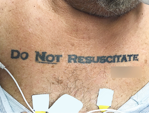 Un hombre llegó inconsciente al hospital con un tatuaje que ponía "no resucitar". Los médicos tuvieron que tomar una decisión