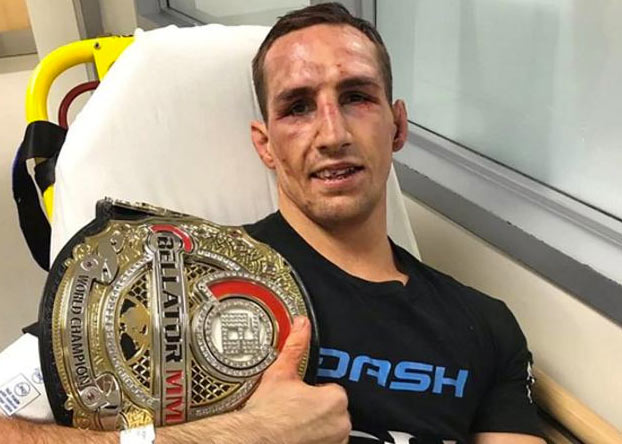 Así quedó la pierna de Rory Macdonald tras ganar el título de Bellator MMA