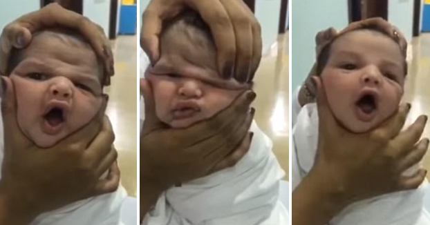 Despiden a tres enfermeras del hospital por deformar la cara de los bebés para divertirse