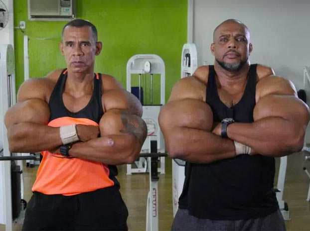 Estos dos hermanos querían ser como Schwarzenegger y ahora están en riesgo de muerte por inyectarse synthol sin control