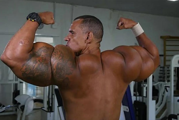 Estos dos hermanos querían ser como Schwarzenegger y ahora están en riesgo de muerte por inyectarse synthol sin control