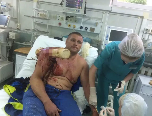 Un parapentista sufre un accidente y un tronco le atraviesa su cuerpo. Cuando llegó al hospital dijo: ''¡Soy Groot!''
