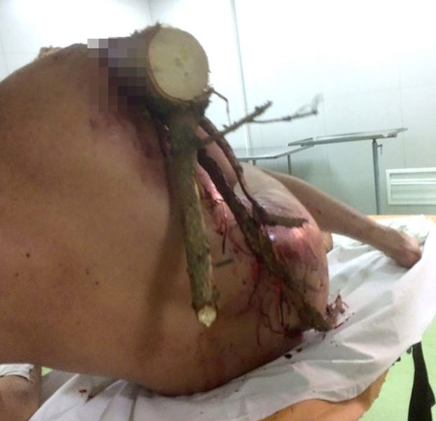 Un parapentista sufre un accidente y un tronco le atraviesa su cuerpo. Cuando llegó al hospital dijo: ''¡Soy Groot!''