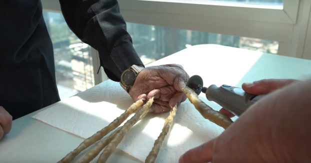 El hombre con las uñas más largas del mundo decide cortárselas después de 66 años. Este es el momento en el que se las cortan