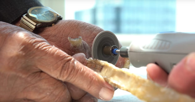 El hombre con las uñas más largas del mundo decide cortárselas después de 66 años. Este es el momento en el que se las cortan