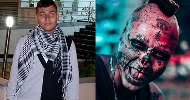 El colombiano de 22 años que se amputó la nariz y las orejas para parecer una calavera