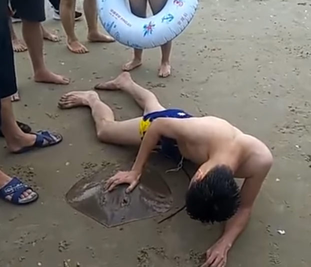 Una raya le pica a un hombre en los genitales mientras nadaba en la playa y la criatura todavía está enganchada cuando llega la ayuda