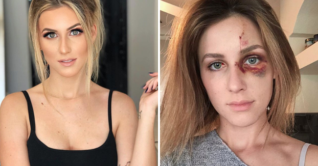 Campeón de Motocross golpeó brutalmente a su novia por una foto en Instagram
