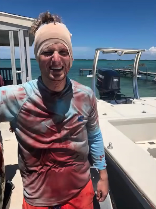 Un tiburón le muerde en la cabeza a un hombre que hacía pesca submarina en las Bahamas