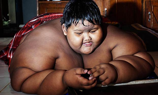 El cambio radical de Arya Permana, el niño más gordo del mundo. Ha perdido 100 kilos