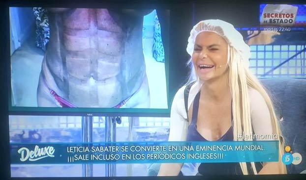 Imagen de los abdominales de Leticia Sabater después de operarse para parecerse a Madonna