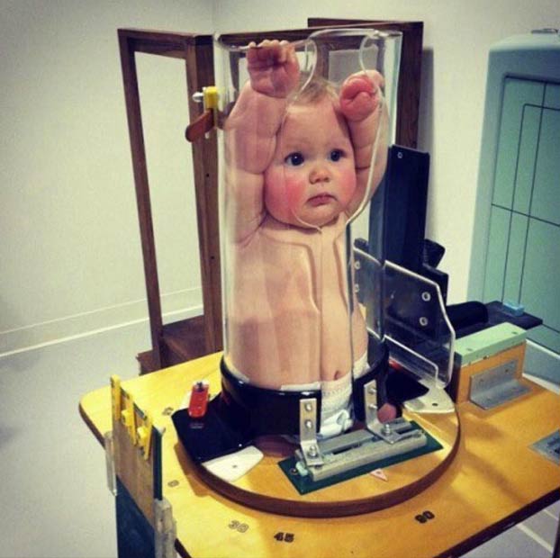 Pigg-O-Stat, la máquina para hacer pruebas de rayos X a bebés