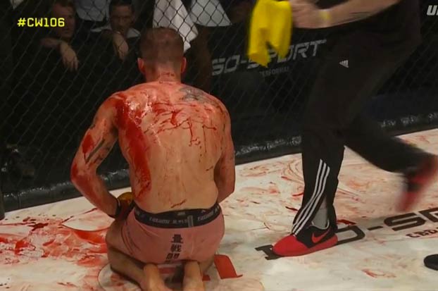 Suspenden un combate de MMA debido al exceso de sangre