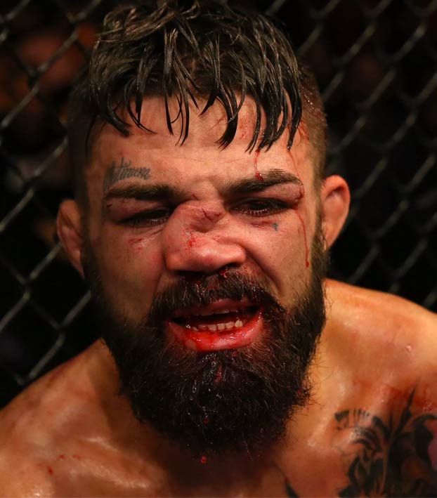 El luchador de la UFC Mike Perry termina con la nariz destrozada después de un rodillazo