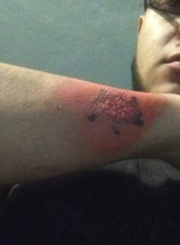 Se hace un tatuaje, no le gusta como queda y se lo saca con un rallador de queso