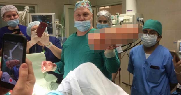 Un hombre tiene que ser operado de urgencia en Rusia para extraerle un consolador gigante del colon