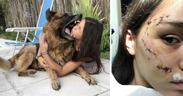 Una adiestradora explica foto a foto el caso del perro que mordió a una chica en la cara durante una sesión de fotos