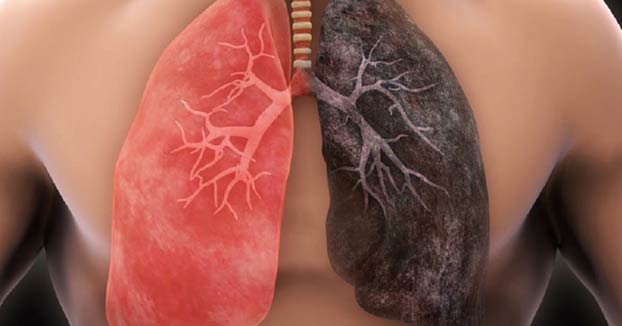 Los pulmones se regeneran si dejas de fumar