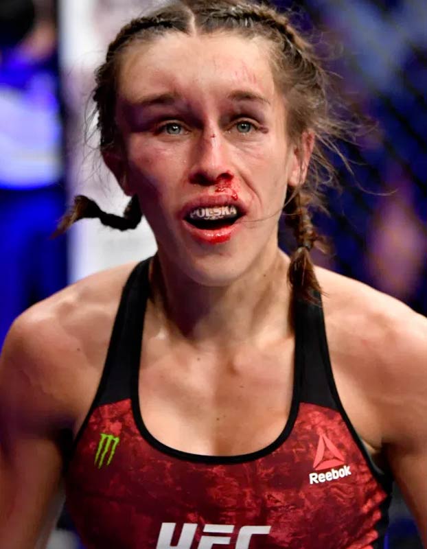 Joanna Jedrzejczyk acaba con la cara deformada en una de las mejores peleas de la historia de la UFC contra Zhang Weili