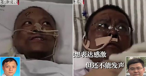 Dos médicos chinos en estado crítico por coronavirus se despiertan con su piel oscurecida