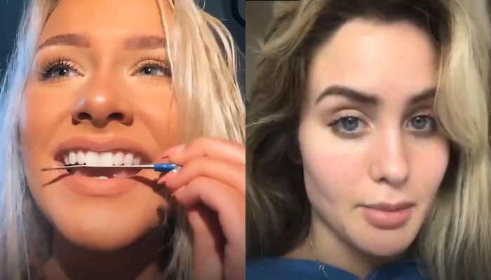 Nueva tendencia peligrosa en TikTok: Limarse los dientes con una lima de uñas para 'emparejarlos'