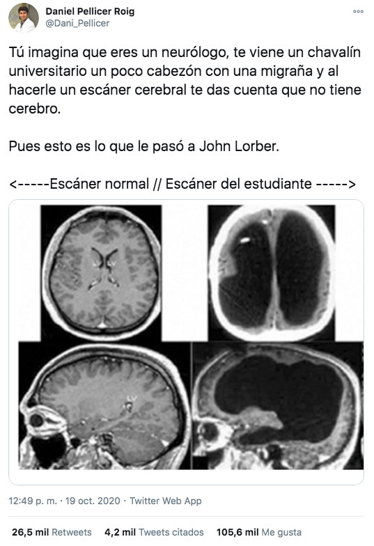 Imagina que eres un neurólogo, te viene un chavalín universitario un poco cabezón con una migraña y al hacerle un escáner cerebral te das cuenta que no tiene cerebro