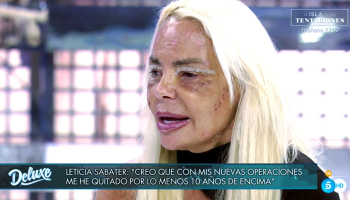 Leticia Sabater: ''Creo que con mis nuevas operaciones me he quitado por lo menos 10 años de encima''