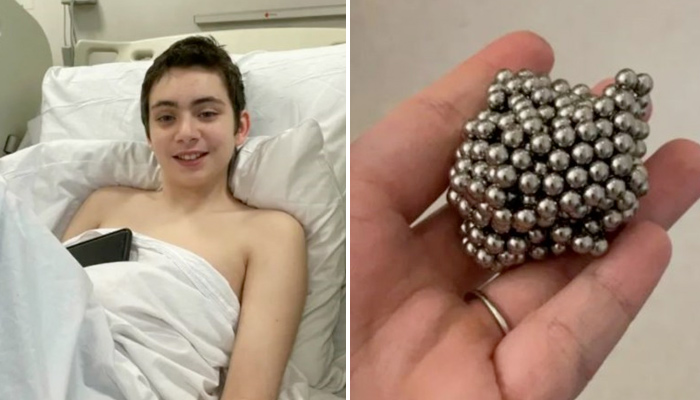 Un chico se tragó 54 imanes para ver si se volvía magnético y tuvieron que  operarlo de urgencia