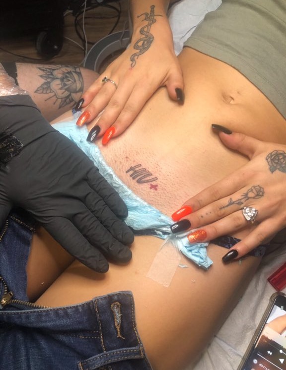 Se tatúa 'VIH positivo' en sus partes para avisar a las personas con las que se acueste que tiene el virus
