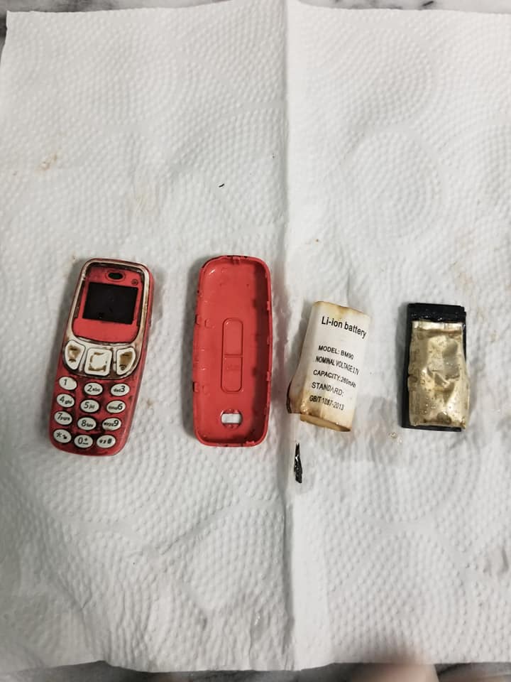 Va al hospital por fuertes dolores de estómago y descubre que se ha tragado un Nokia 3310