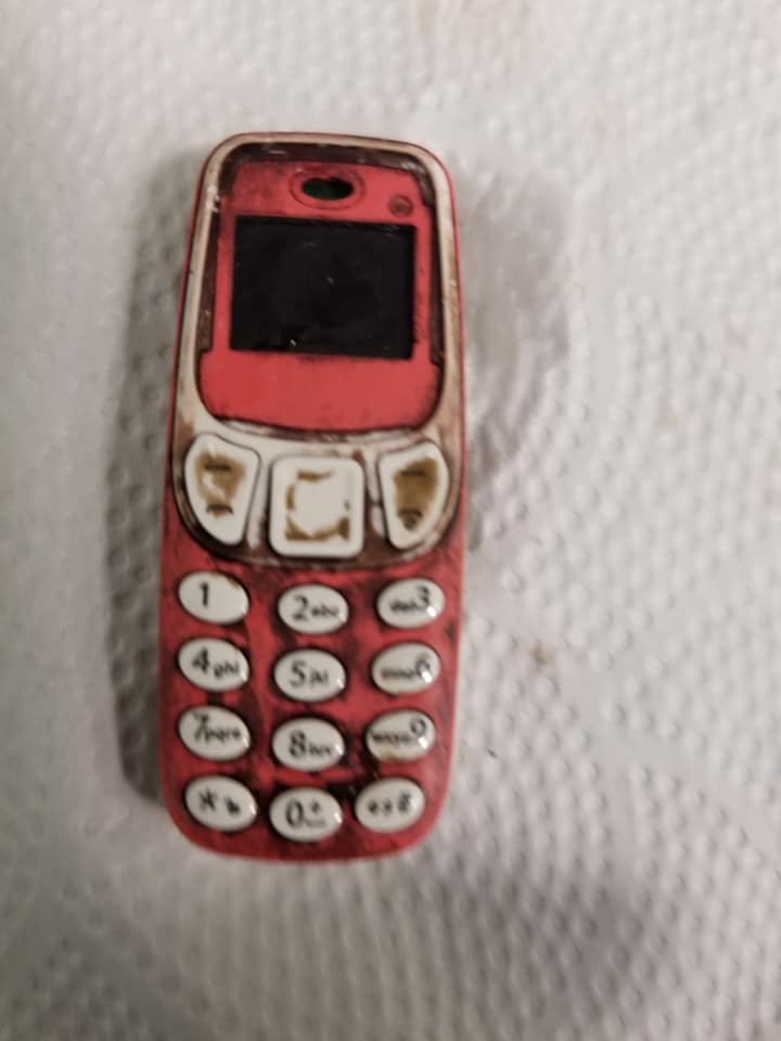 Va al hospital por fuertes dolores de estómago y descubre que se ha tragado un Nokia 3310