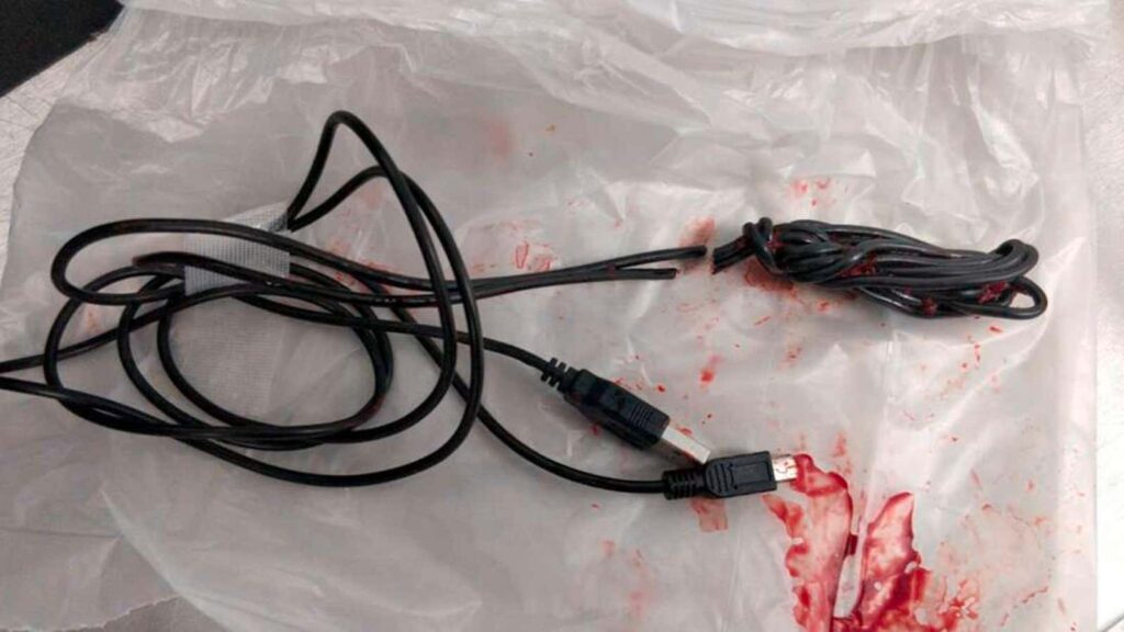Un joven termina en urgencias después de intentar medir el interior de su pene con un cable USB