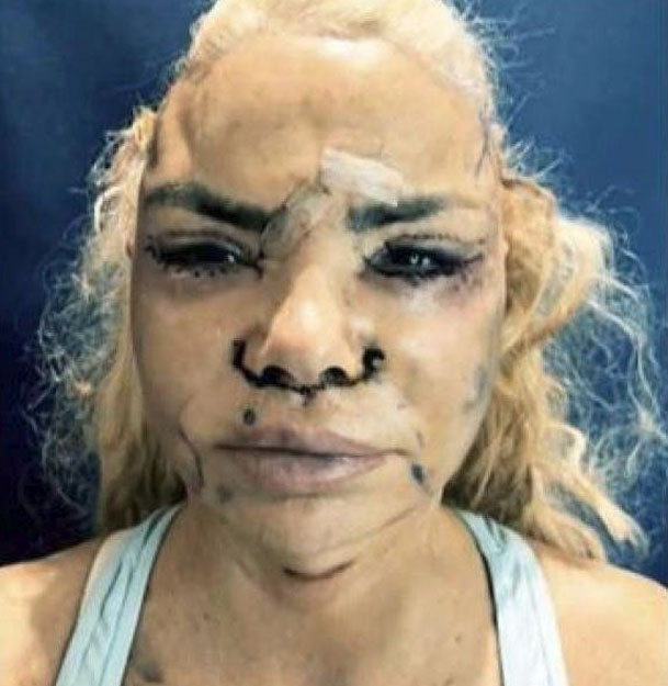 Leticia Sabater se ha operado la cara...